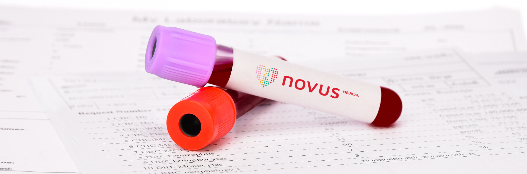 Analize medicale Ploiesti. Recoltare analize Ploiesti