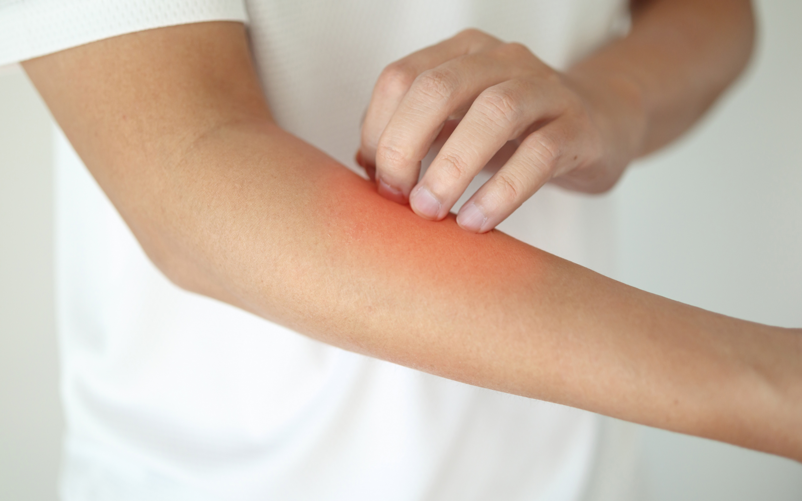 Dermatită atopică, simptome, pusee și consult dermatologic la Novus Medical Ploiești