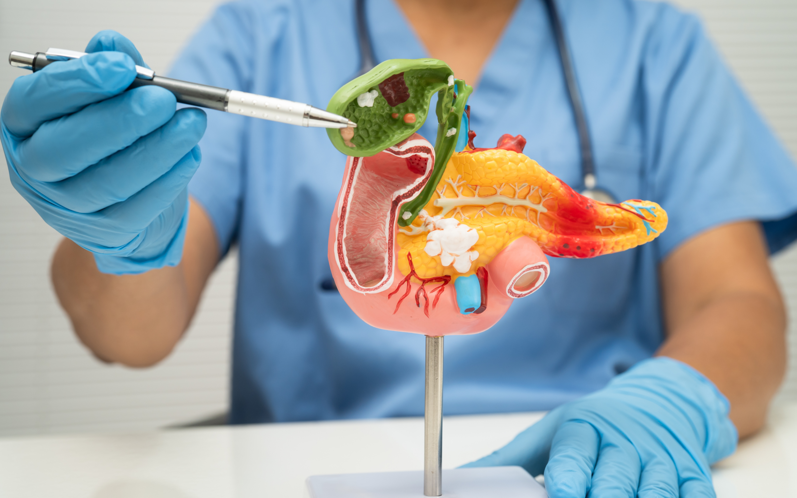 Pietre la fiere, simptome și investigații la Novus Medical Ploiești